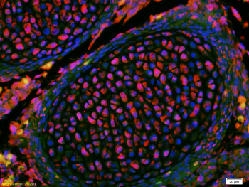 KLF2 Rabbit Polyclonal Antibody