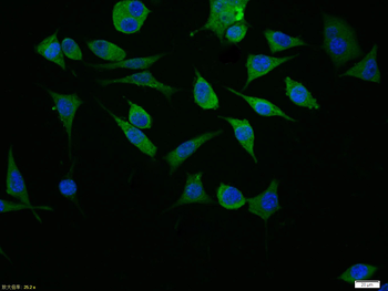 MDR1 Rabbit Polyclonal Antibody