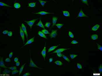 MDR1 Rabbit Polyclonal Antibody