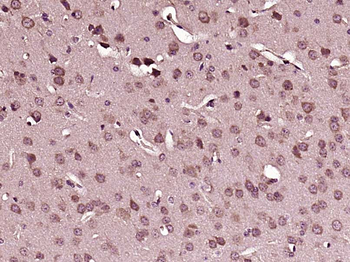 MUP1 Rabbit Polyclonal Antibody