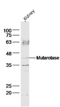 Mutarotase Rabbit Polyclonal Antibody