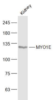 MYO1E Rabbit Polyclonal Antibody