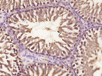Myosin 1C Rabbit Polyclonal Antibody