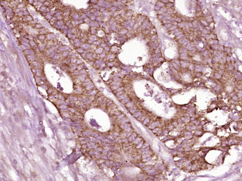 N ras + c Ha ras Rabbit Polyclonal Antibody