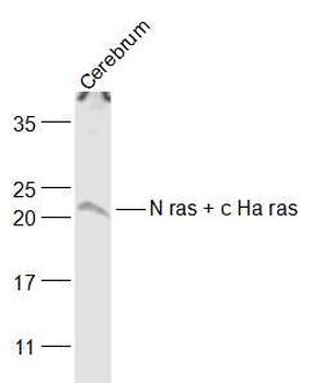 N ras + c Ha ras Rabbit Polyclonal Antibody