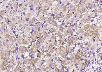 NALP5 Rabbit Polyclonal Antibody