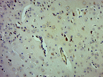 NAP1/C12orf30 Rabbit Polyclonal Antibody