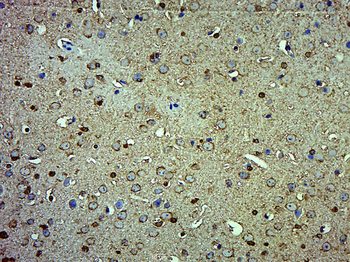 NARFL Rabbit Polyclonal Antibody