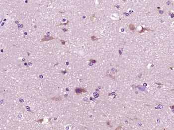 NBPF10 Rabbit Polyclonal Antibody