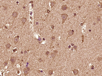 NBPF8 Rabbit Polyclonal Antibody