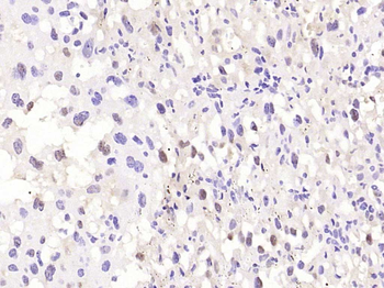 NCBP1 Rabbit Polyclonal Antibody