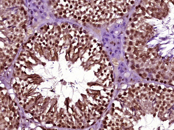 NCOA5 Rabbit Polyclonal Antibody