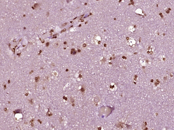 NCRNA00114 Rabbit Polyclonal Antibody