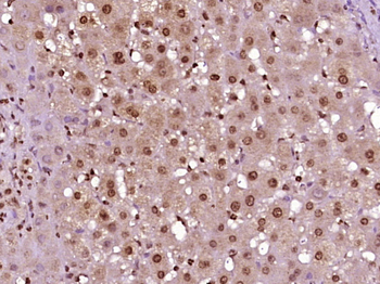 NCRNA00114 Rabbit Polyclonal Antibody