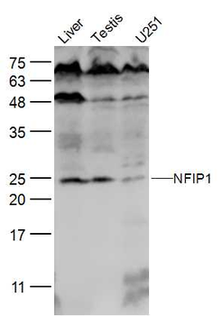 NFIP1 Rabbit Polyclonal Antibody