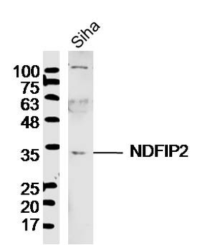 NDFIP2 Rabbit Polyclonal Antibody