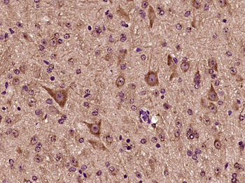 NDOR1 Rabbit Polyclonal Antibody