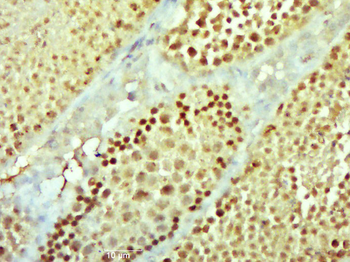 NEK11 Rabbit Polyclonal Antibody