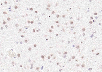 NR1D1 Rabbit Polyclonal Antibody