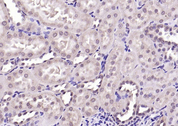 Nesprin 3 Rabbit Polyclonal Antibody