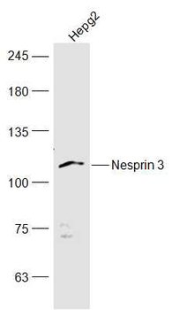 Nesprin 3 Rabbit Polyclonal Antibody