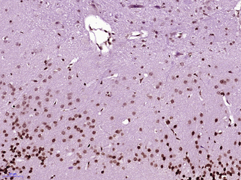 NFKBIL1 Rabbit Polyclonal Antibody