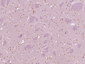 NKRF Rabbit Polyclonal Antibody