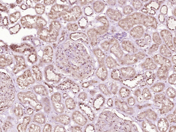 NKX1-1 Rabbit Polyclonal Antibody