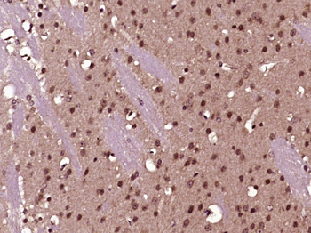NOL4 Rabbit Polyclonal Antibody