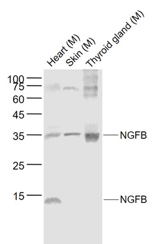 NGFB Rabbit Polyclonal Antibody