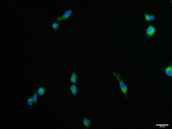 NGFB Rabbit Polyclonal Antibody