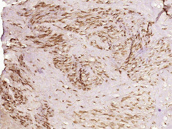 TAF15/RBP56 Rabbit Polyclonal Antibody