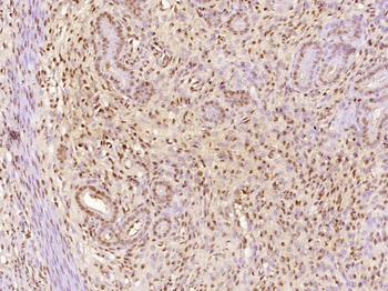 TAF15/RBP56 Rabbit Polyclonal Antibody