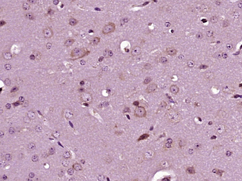 NRDE2 Rabbit Polyclonal Antibody