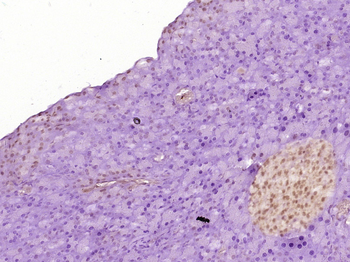 PRKCBP1 Rabbit Polyclonal Antibody