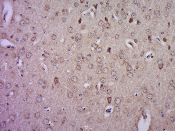 Reelin Rabbit Polyclonal Antibody