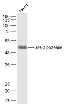 Site 2 protease Rabbit Polyclonal Antibody