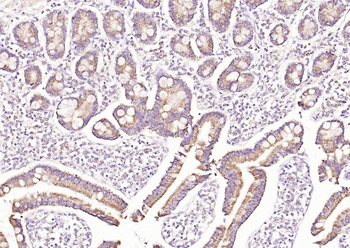 SAA1 Rabbit Polyclonal Antibody