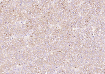 SAA1 Rabbit Polyclonal Antibody