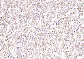 SAA1 Rabbit Polyclonal Antibody