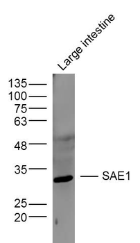 SAE1 Rabbit Polyclonal Antibody