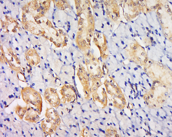 VEGFR2 Rabbit Polyclonal Antibody