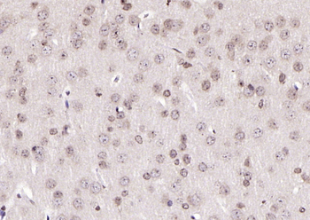 ZFP72 Rabbit Polyclonal Antibody
