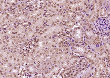 ZFP72 Rabbit Polyclonal Antibody