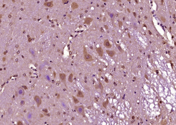 ZFP759 Rabbit Polyclonal Antibody