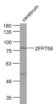 ZFP759 Rabbit Polyclonal Antibody