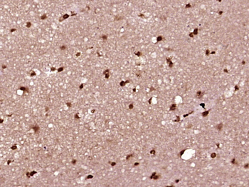 ZFP92 Rabbit Polyclonal Antibody