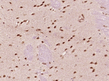 ZFP92 Rabbit Polyclonal Antibody