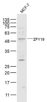 ZFY19 Rabbit Polyclonal Antibody