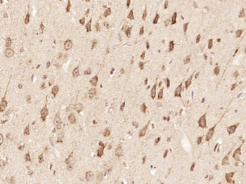 ZFYVE26 Rabbit Polyclonal Antibody